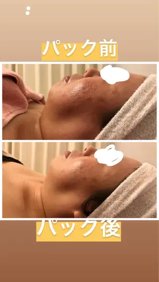 佐藤 加奈のエステ・リラクイメージ