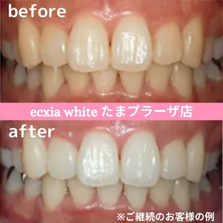 セルフホワイトニング　エクシアたまプラーザ店所属・yukari - オーナー -のその他イメージ
