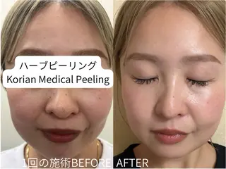 LUVRE龍田 MIKIまつ毛/眉毛の眉毛・アイブロウイメージ