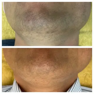 salon   de epilaのエステ・リラクイメージ