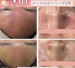 アロマ&アーユルヴェーダサロンParadiso横浜所属・冨菜 みらいのエステ・リラクイメージ