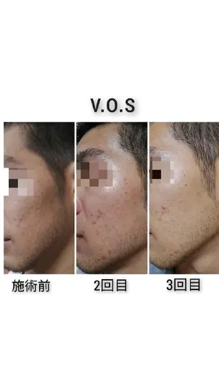 N. pauleleのマツエク・マツパデザイン