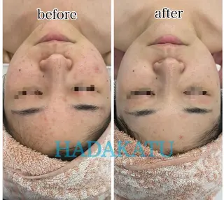 総合エステサロン 肌活のエステ・リラクイメージ