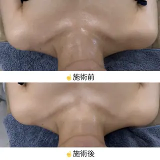 相模原/毛穴/ニキビ フェイシャルRikoのエステ・リラクイメージ