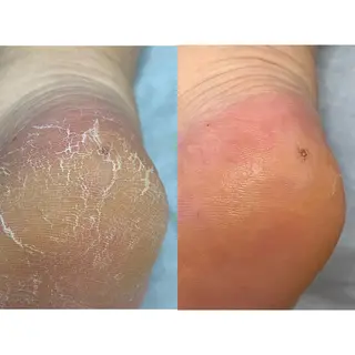 ネイル Takasaki Keikoのネイルデザイン