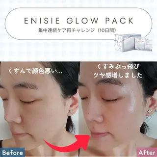 痩身ハーブピーリング 筋膜リリース☆B&Hのエステ・リラクイメージ