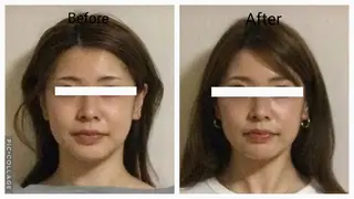 小顔矯正Sho  FaceDesignのエステ・リラクイメージ