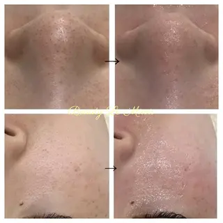 ビューティー ミロワールのエステ・リラクイメージ