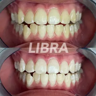 Libra所属・LIBRA心斎橋 セルフホワイトニングのその他イメージ