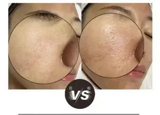 ショート カラー パーマ ネイル マツエク・マツパ aliaハーブ水光店 エステティシャン募集のエステ・リラクイメージ