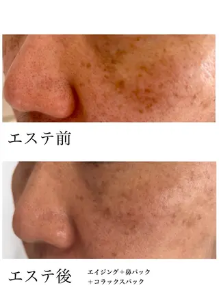 YUI🤍乾燥ゆらぎ 肌🌿即透明感✨のエステ・リラクイメージ