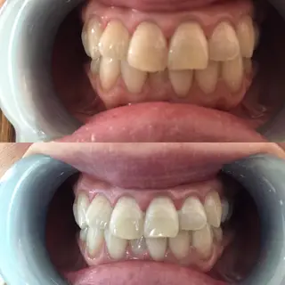 miya norikoの眉毛・アイブロウイメージ