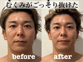 肌質改善×美容鍼 ゆいのエステ・リラクイメージ