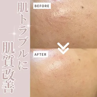内間 芹奈のエステ・リラクイメージ