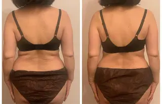 アンベリーノ Yuuriのエステ・リラクイメージ