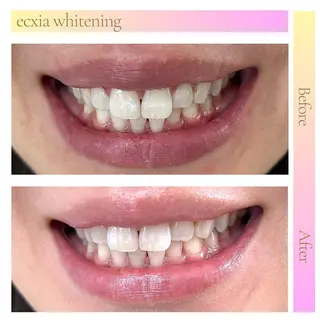 ecxia新白河店 ゆきのその他イメージ