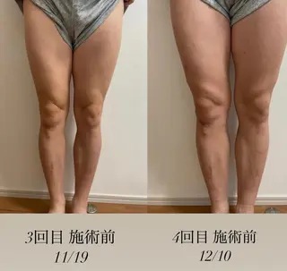 エステサロン Mi-mi.iのエステ・リラクイメージ