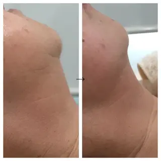 ビューティー ミロワールのエステ・リラクイメージ