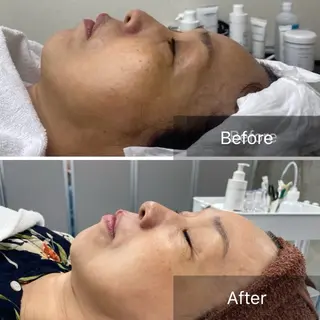 Lis Rose🥀 フェイシャルサロンのエステ・リラクイメージ