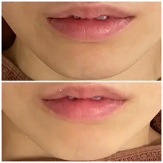 ロング カラー パーマ ヘアアレンジ メンズ キッズ ネイル アイブロウ 3か月で肌革命👼 ニキビ専門店💫のエステ・リラクイメージ