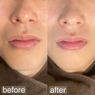 メンズ アイブロウ&フェイシャルサロンa‘lm所属・WAX脱毛/肌質改善 眉毛とお肌のサロンのエステ・リラクイメージ