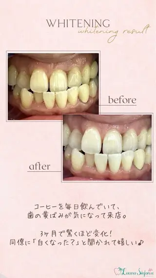 橋口 花菜子のその他イメージ