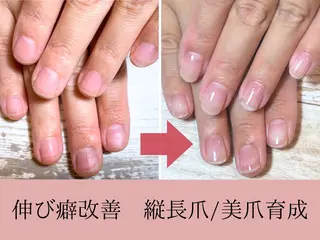 ネイル 深爪矯正・自爪育成 ネイルサロンアモここのネイルデザイン