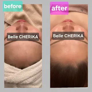 ベル チェリカ 三城のエステ・リラクイメージ