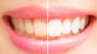 ホワイトニング/脱毛 サロン　麗　御徒町のその他イメージ