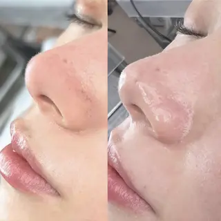 SLEEPbyRe  Naoのマツエク・マツパデザイン