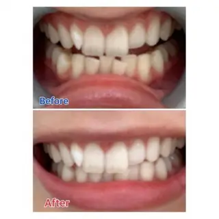 Ｍ渋谷 ホワイトニングのエステ・リラクイメージ