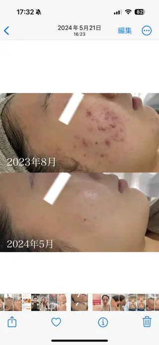 小顔リフトアップ 美肌改善専門店のエステ・リラクイメージ