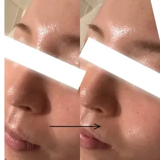 UEDA | POLA 天王寺のエステ・リラクイメージ