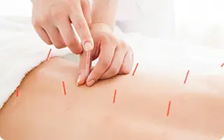 美容鍼灸サロン APLUSのエステ・リラクイメージ