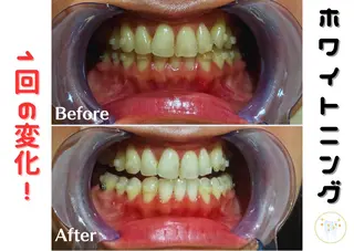 R-four🦋 土屋のエステ・リラクイメージ