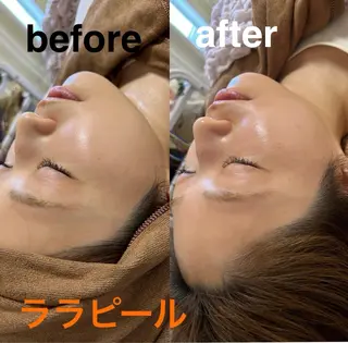 鍼灸サロン mahorobaトモのエステ・リラクイメージ