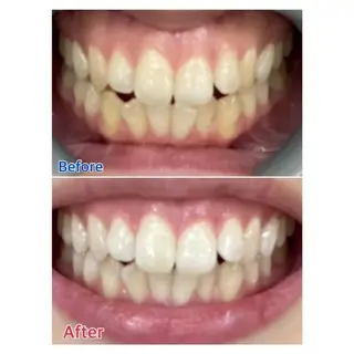 Ｍ渋谷 ホワイトニングのエステ・リラクイメージ