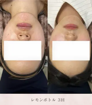 看護師が施術する美容 ナスサロshokoのエステ・リラクイメージ