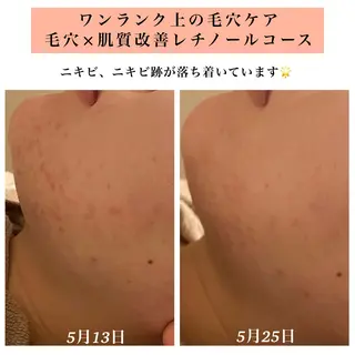 Bellesthe (ベルエステ)のエステ・リラクイメージ