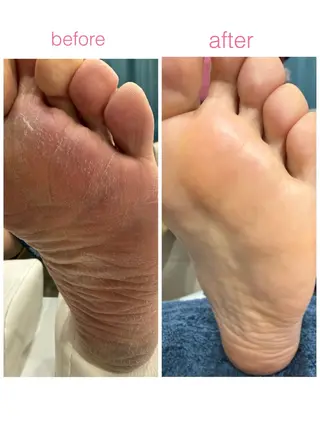 ネイル arm in arm ︎✿Yamamotoのマツエク・マツパデザイン