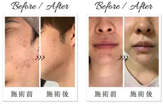 リヴァージュ rivageの眉毛・アイブロウイメージ