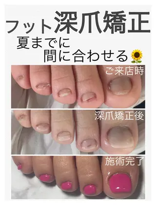 ネイル nail salon petillantのネイルデザイン
