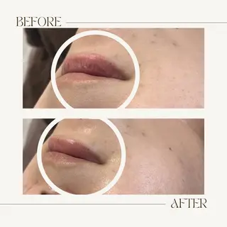 1st｜フェイシャル エステ専門店のエステ・リラクイメージ