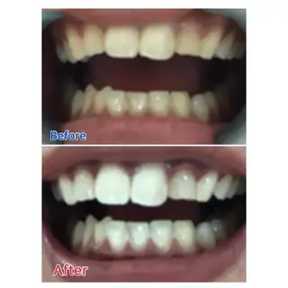 M渋谷 ホワイトニングのエステ・リラクイメージ