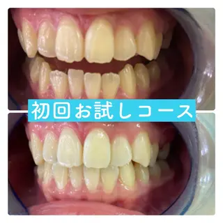 ホワイトニングルーム 横浜店のその他イメージ