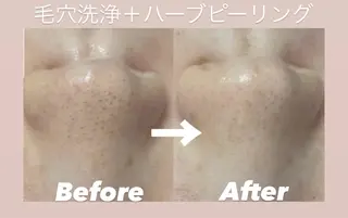 韓国肌管理 Belle堀江のエステ・リラクイメージ