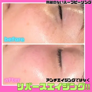 痩身&美肌サロン 堀米✨のその他イメージ