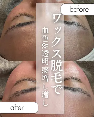 una salon / ネイル&顔脱毛のネイルデザイン