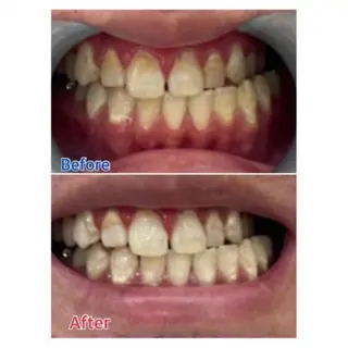 Ｍ渋谷 ホワイトニングのエステ・リラクイメージ