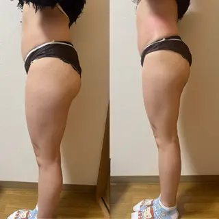 Amaranth所属・Lupinus 小顔矯正のエステ・リラクイメージ